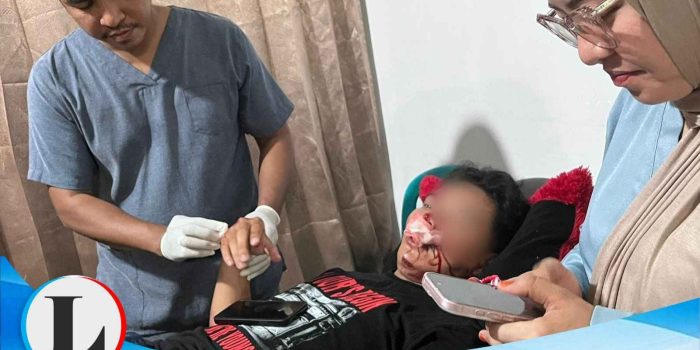 Sapi Berkeliaran Picu Kecelakaan, Pengendara di Pagimana Mengalami Sejumlah Luka